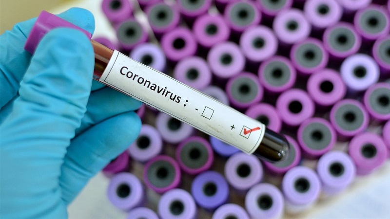 Brasil confirma primer caso de coronavirus en Latinoamérica