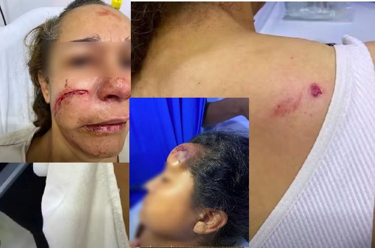 Violencia en el Hospital del Sarare, tres funcionarios fueron agredidos durante atención a un paciente
